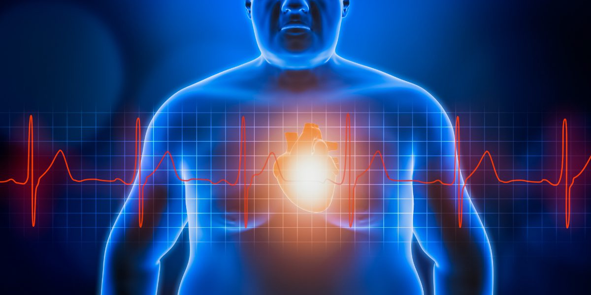 Why Overweight Can Be Dangerous To Your Health and How Our Slenderiiz Program Can Help You Achieve Your Weight Loss Goals